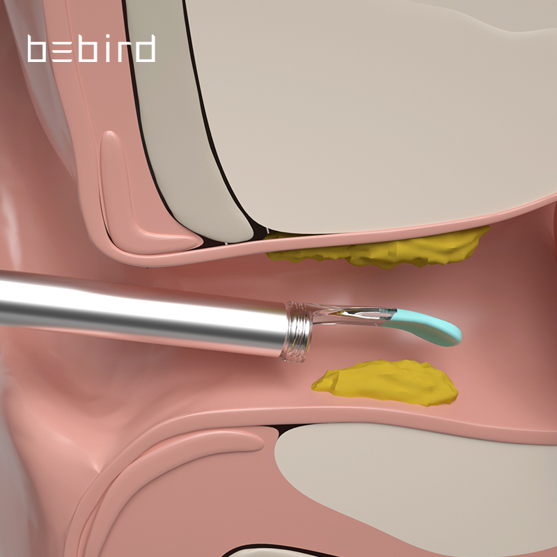Bebird original factory otoscope smart visual ear cleaner ear wax remover vacuum ear cleaner wax removal tool